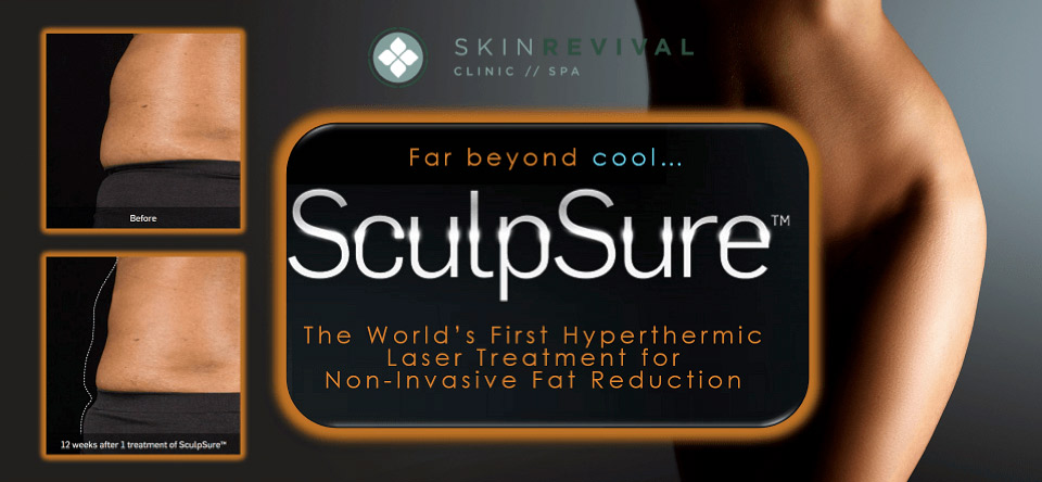 SculpSure vs. Liposuction: Choosing the Right Body Contouring Option for  You - Ascent Laser Aesthetics