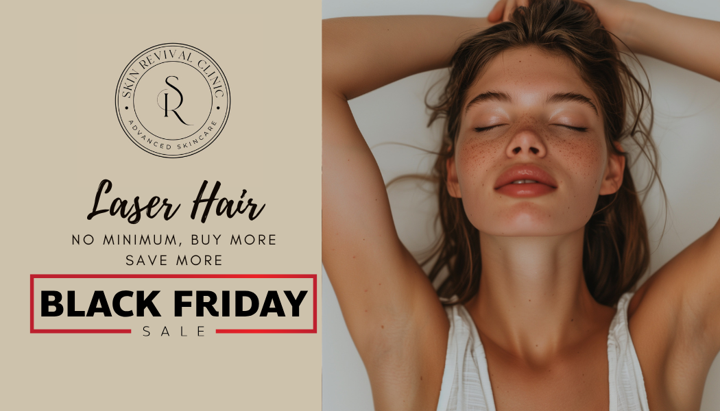 Laser Deals Black Friday
